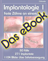implantologie 1